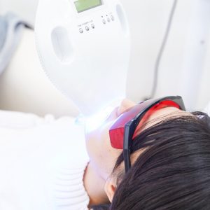 ホワイトニングショップ 高知店_ホワイトニング