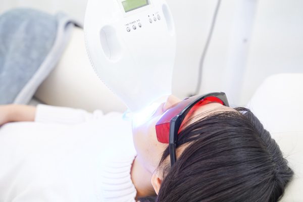 ホワイトニングショップ 高知店_ホワイトニング